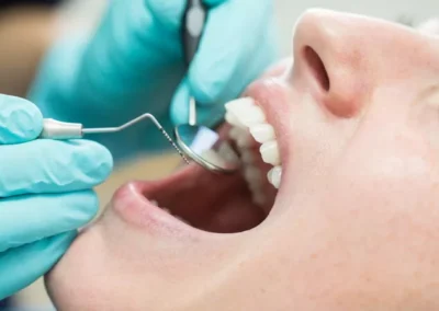 HUFFPOST – Denti di lusso. Curarsi la bocca sempre più un privilegio: molti ci rinunciano o ricorrono al fai da te
